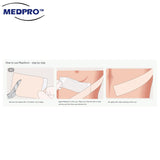 Molnlycke Mepiform 4 x 30cm | 5 x 7.5cm | 10 x 18cm (1 Box, 5pcs)